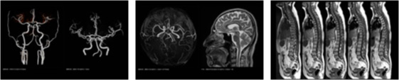 TOSHIBA MRI Vantage Titanを使用した高画質画像